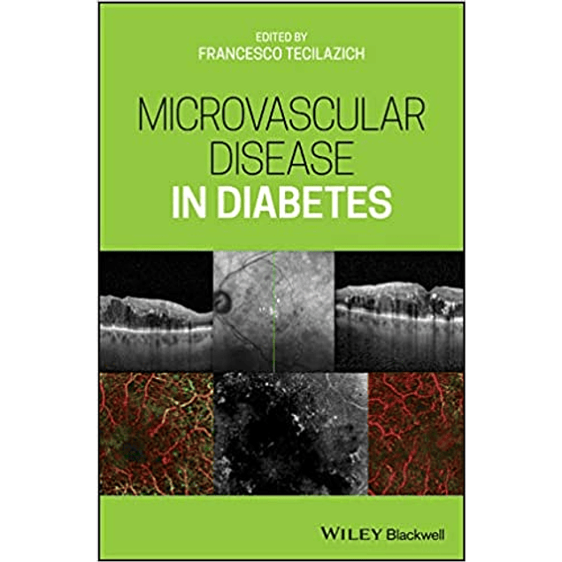  Microvascular Disease in Diabetes 