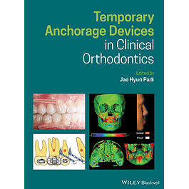 Temporary Anchorage Devices in Clinical Orthodontics
