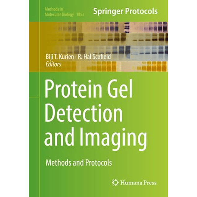 Protein Gel Detection and Imaging: Methods and Protocols