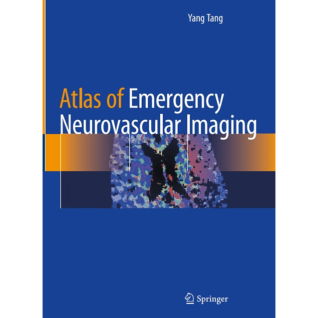 Atlas of Emergency Neurovascular Imaging