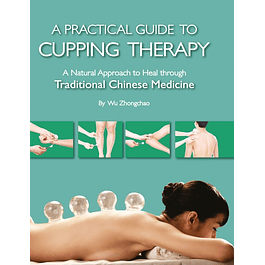 A Practical Guide to Cupping Therapy: A Natural Approach to Heal Through Traditional Chinese Medicine