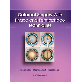 Cataract Surgery With Phaco and Femtophaco Techniques 