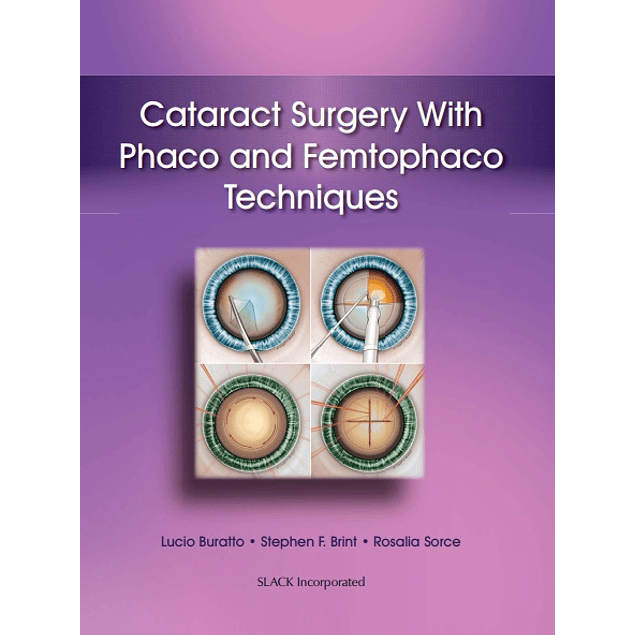 Cataract Surgery With Phaco and Femtophaco Techniques 