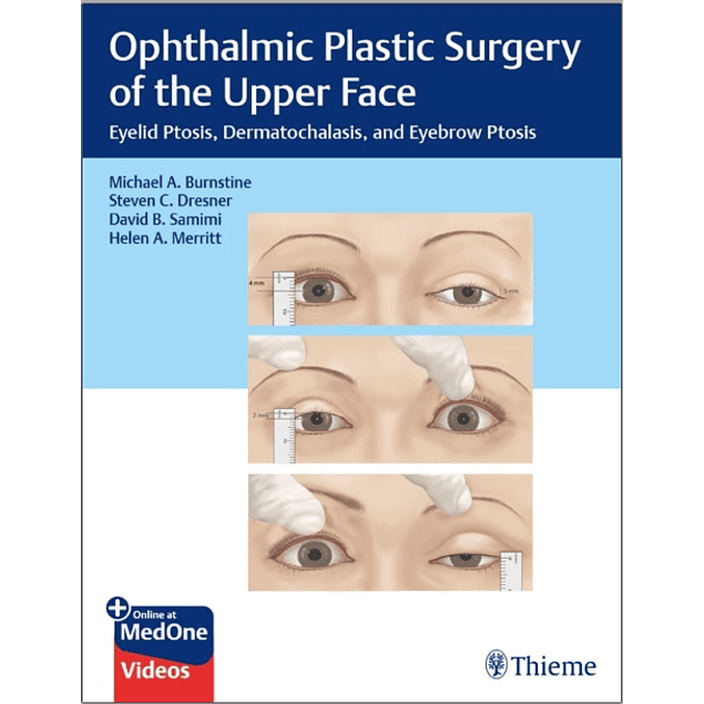Ophthalmic Plastic Surgery of the Upper Face: Eyelid Ptosis, Dermatochalasis, and Eyebrow Ptosis