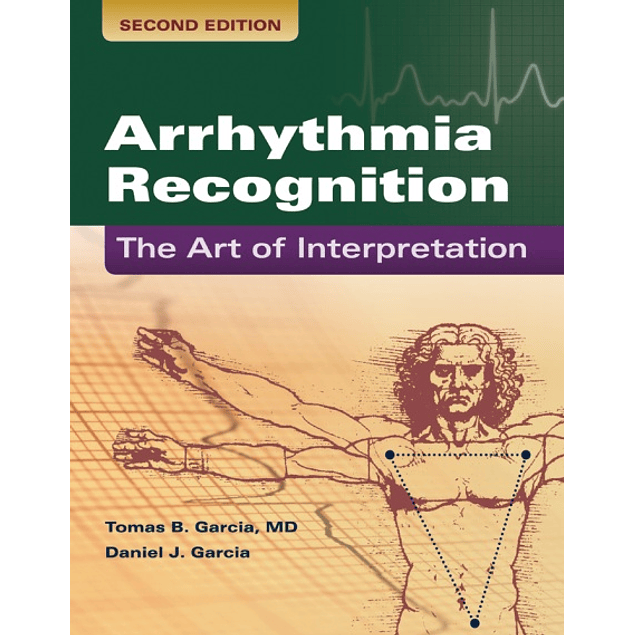  Arrhythmia Recognition: The Art of Interpretation 