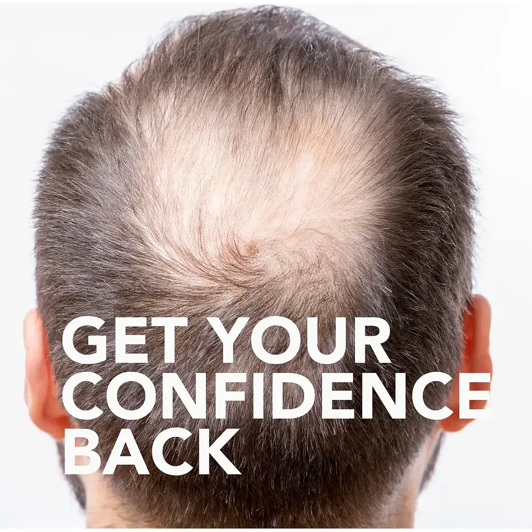 Tratamiento para el crecimiento del cabello GoodSense Minoxidil 5% 360 ml para hombres 7