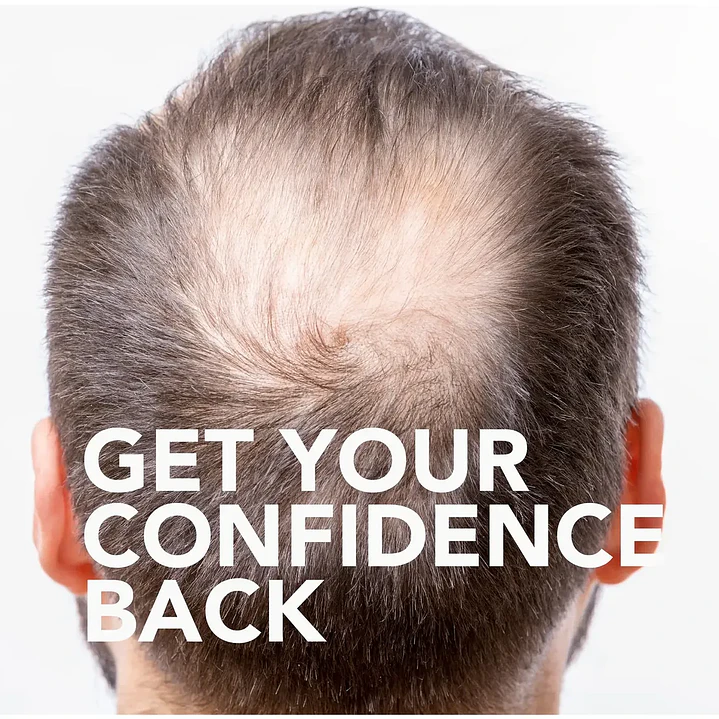 Tratamiento para el crecimiento del cabello GoodSense Minoxidil 5% 360 ml para hombres 7