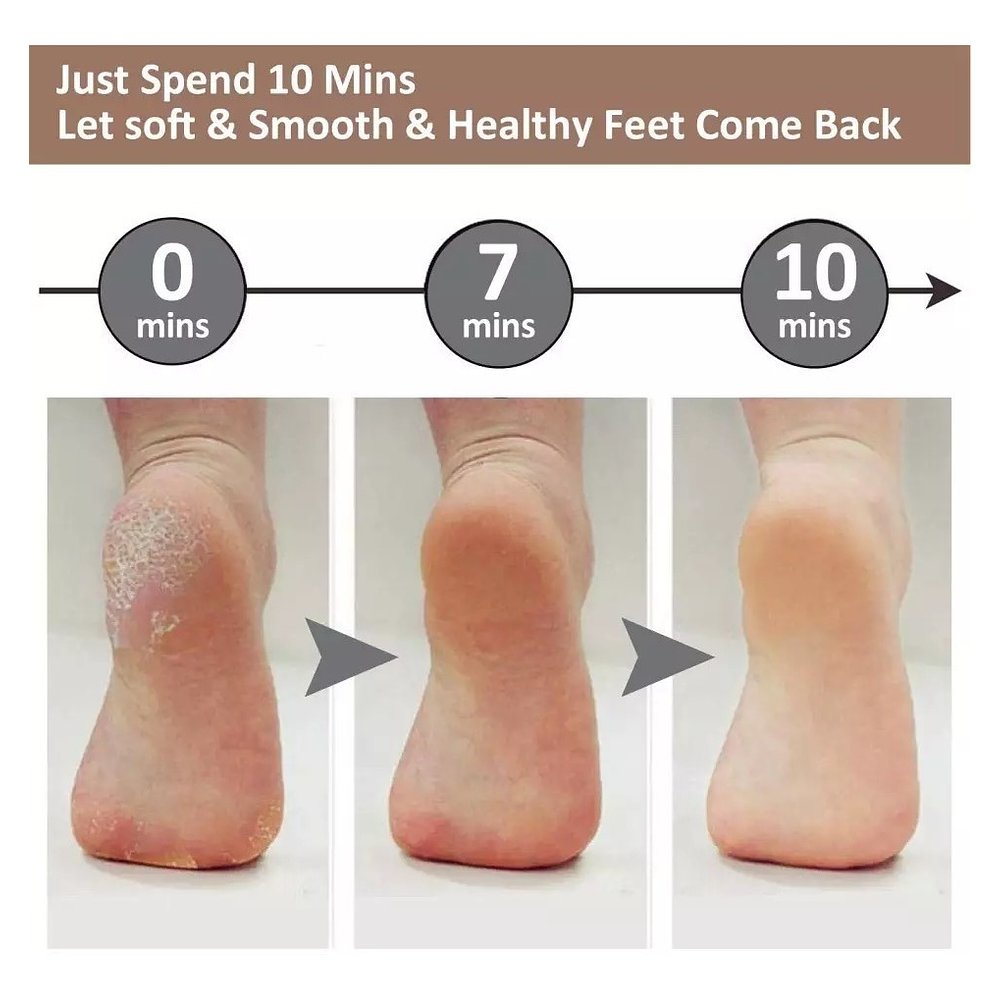 REMOVEDOR SACA DE CALLOS Y EXFOLIADOR PIES Y MANOS USB RECARGABLE