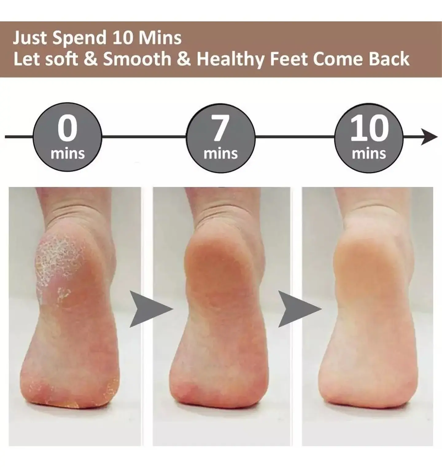 REMOVEDOR SACA DE CALLOS Y EXFOLIADOR PIES Y MANOS USB RECARGABLE 3