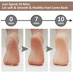 REMOVEDOR SACA DE CALLOS Y EXFOLIADOR PIES Y MANOS USB RECARGABLE