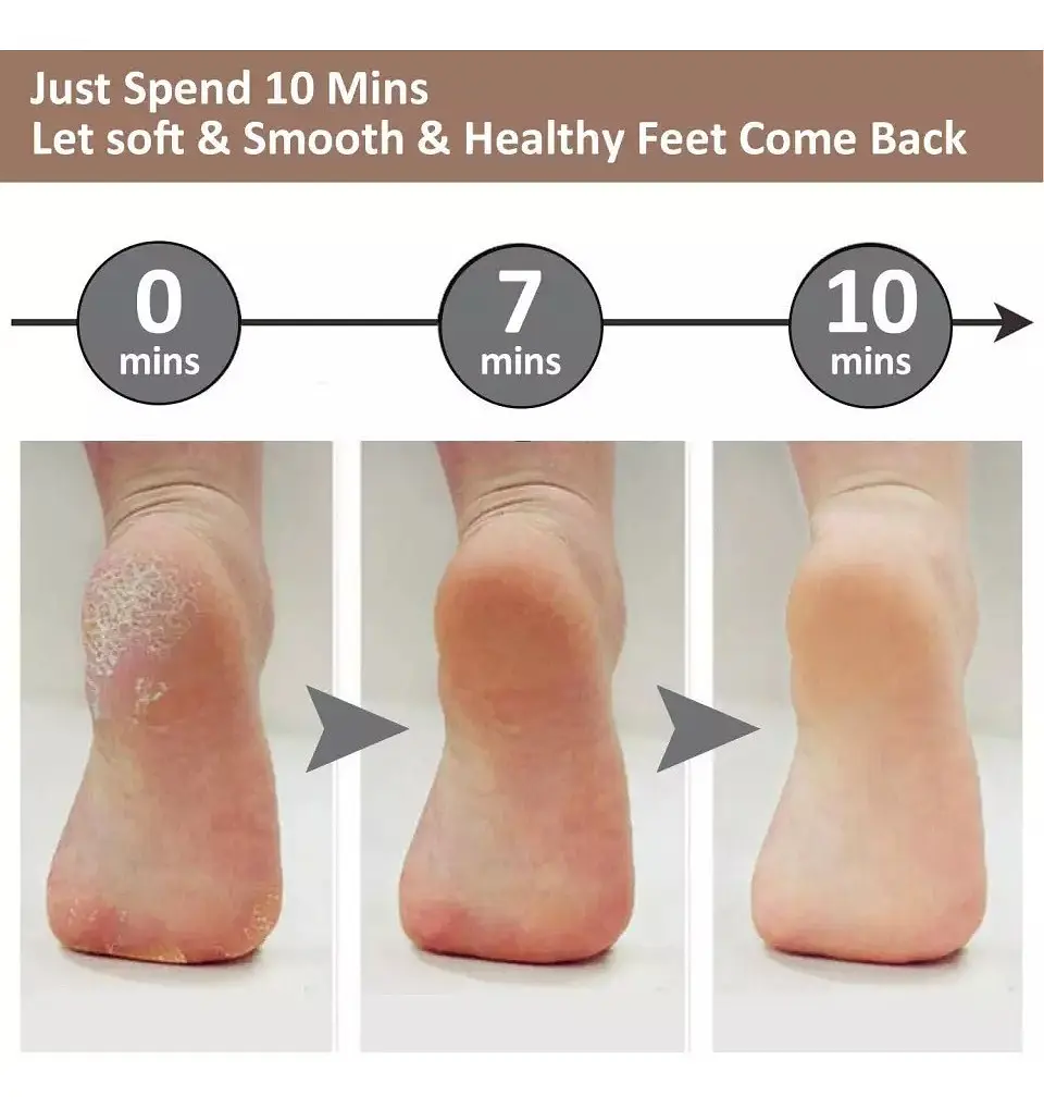 REMOVEDOR SACA DE CALLOS Y EXFOLIADOR PIES Y MANOS USB RECARGABLE 3