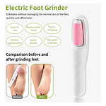REMOVEDOR SACA DE CALLOS Y EXFOLIADOR PIES Y MANOS USB RECARGABLE