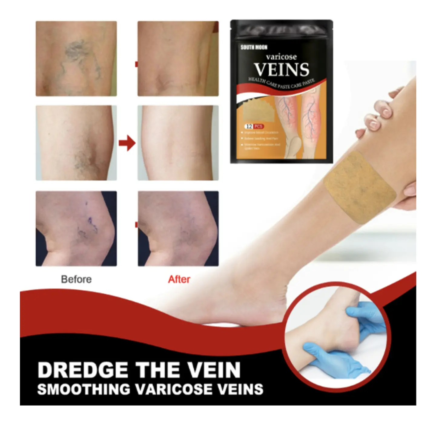 PARCHE PARA VARICES PACK 12 UNIDADES- POR MAYOR 3