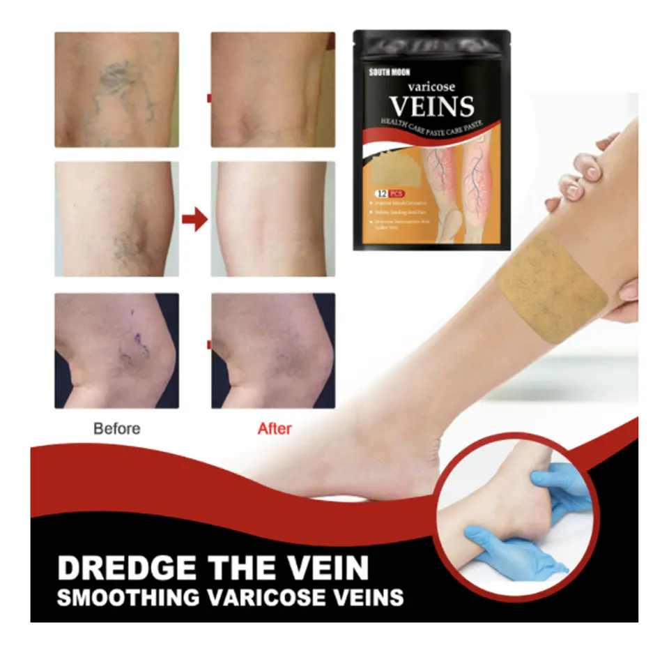 PARCHE PARA VARICES PACK 12 UNIDADES- POR MAYOR 3