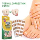 KIT DE PARCHES PARA CORREGIR Y ALIVIAR EL DOLOR DE UÑAS ENCARNADAS CAJITA 30UNDS- POR MAYOR - Miniatura 1