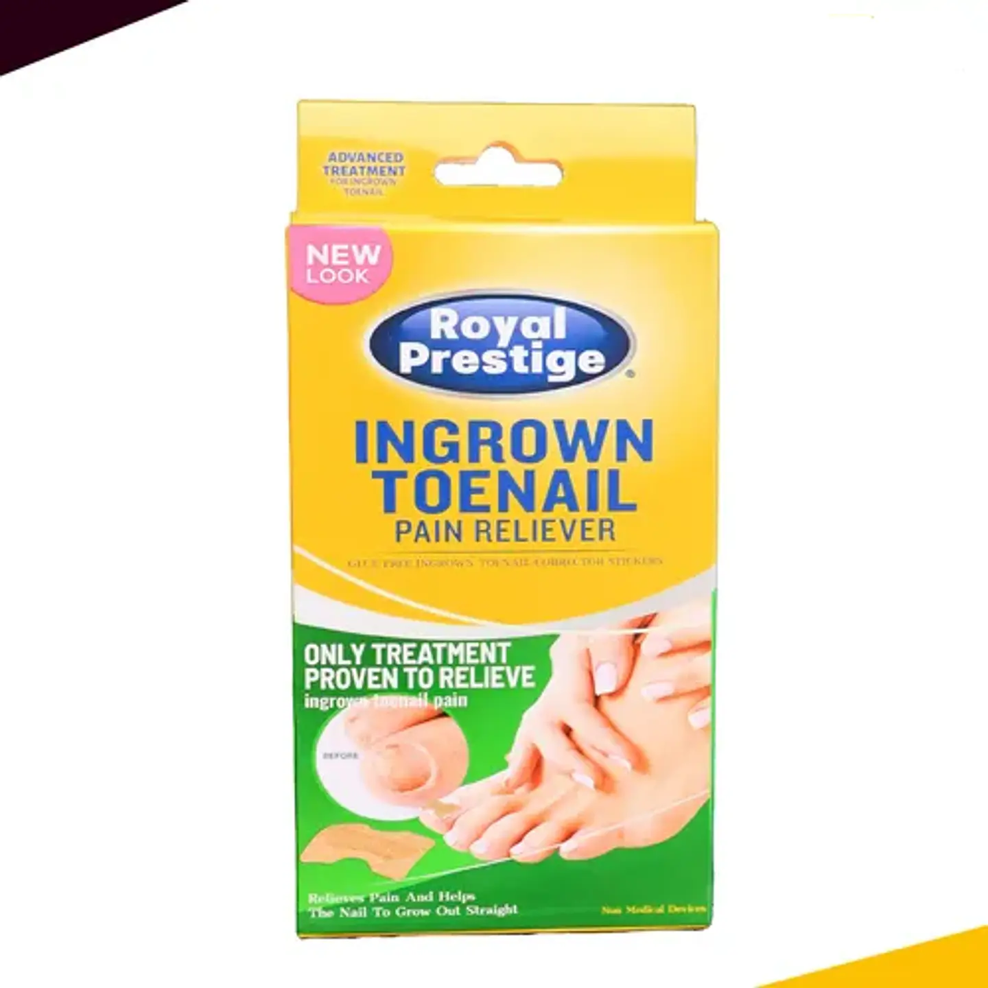 KIT DE PARCHES PARA CORREGIR Y ALIVIAR EL DOLOR DE UÑAS ENCARNADAS CAJITA 30UNDS- POR MAYOR 7