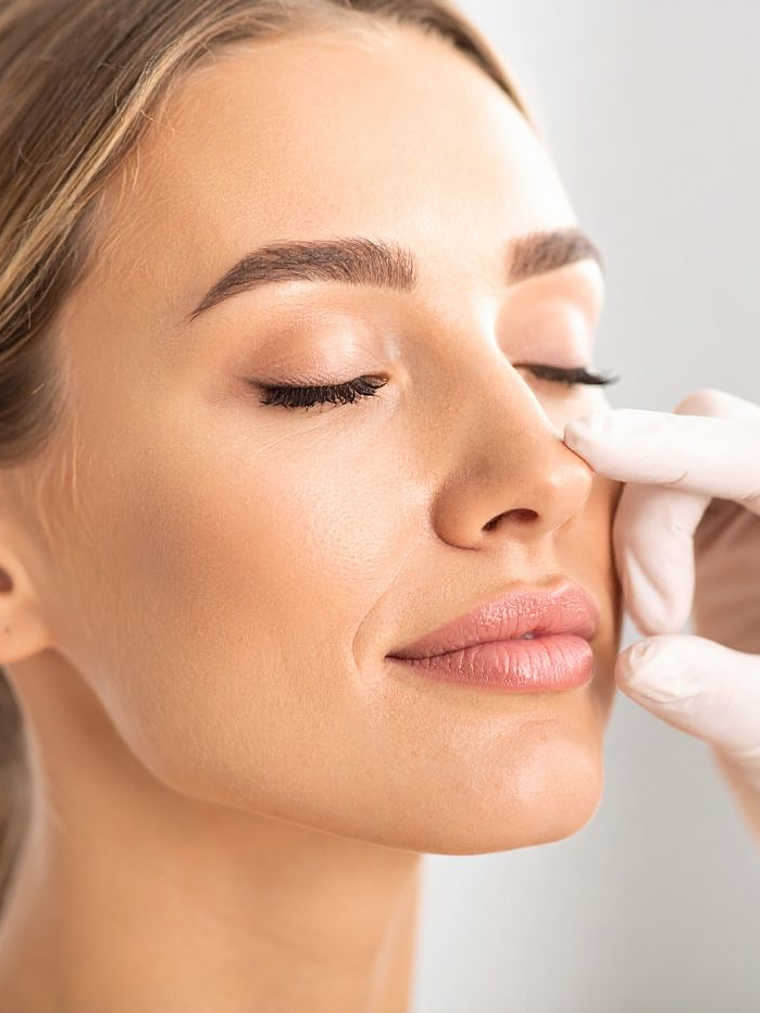 Rinomodelación con ácido hialurónico 1