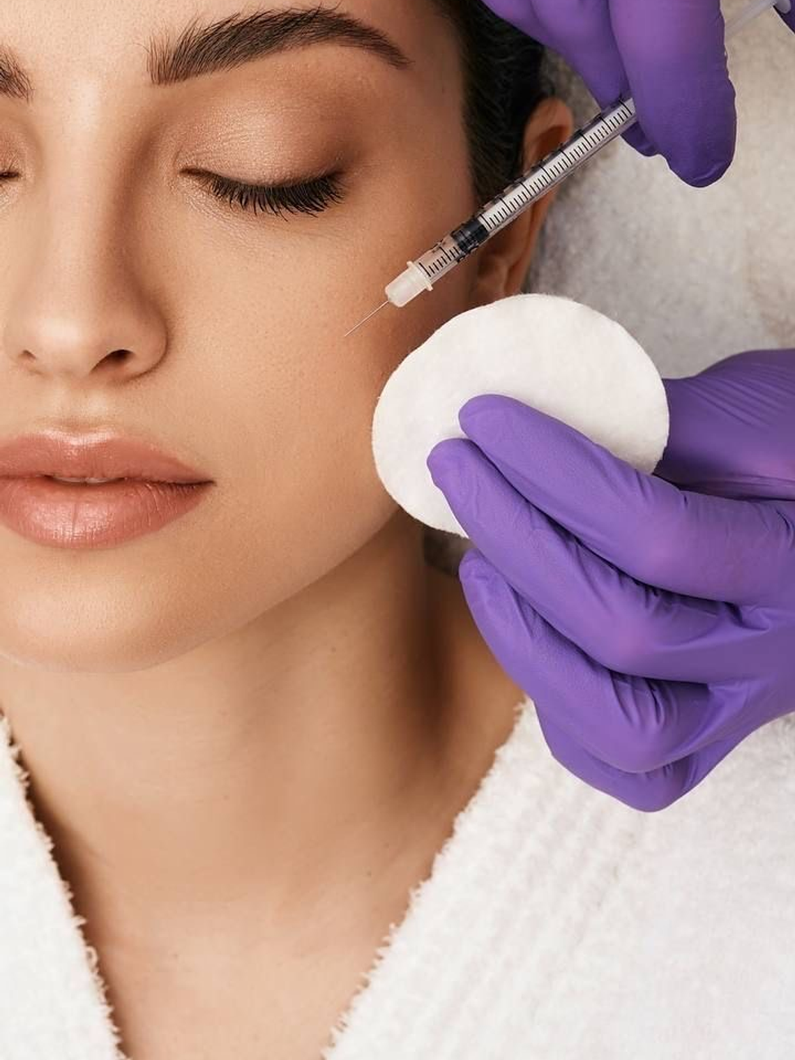 Relleno de pómulos 1