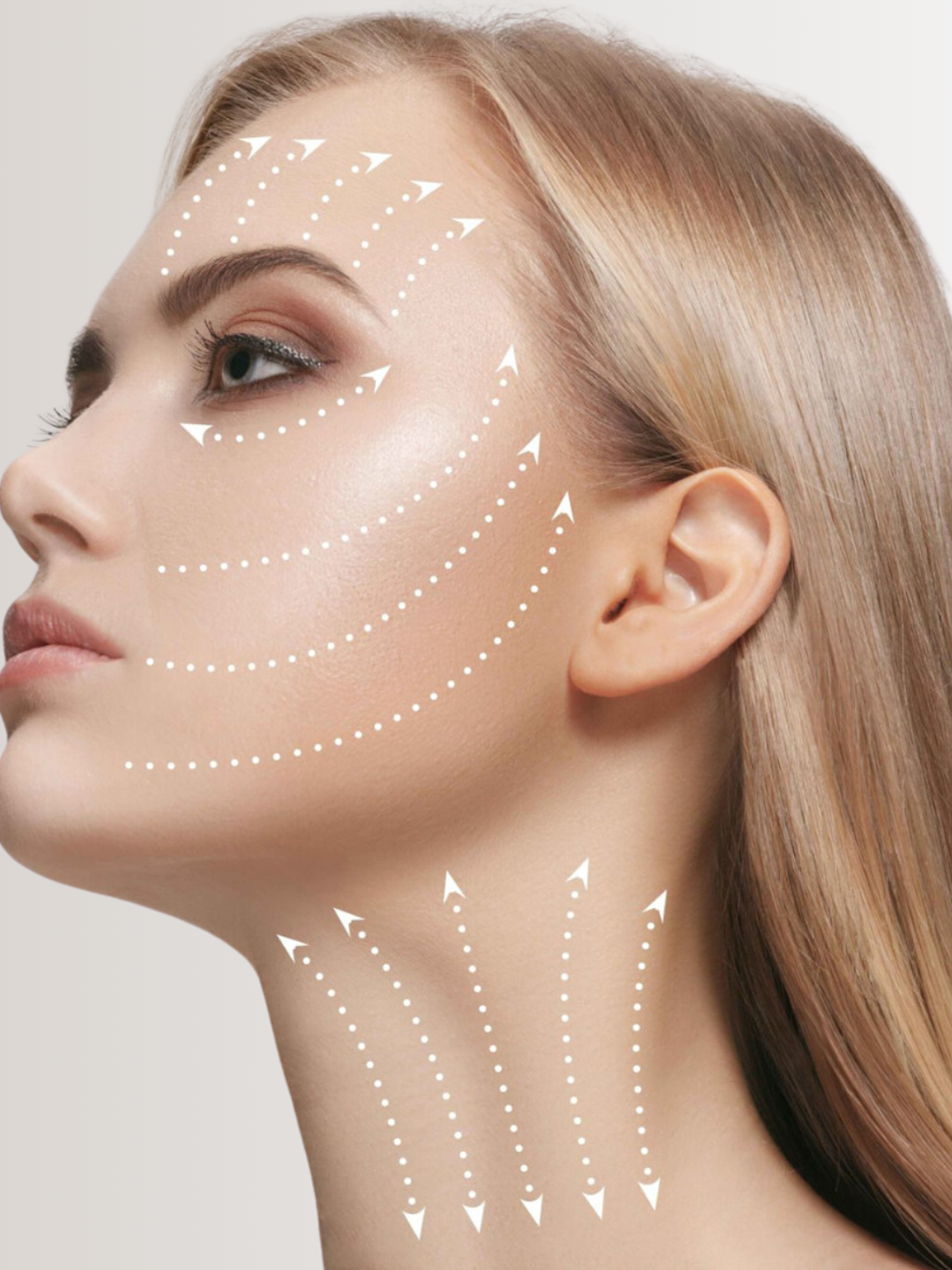 Hilos revitalizantes PDO 1