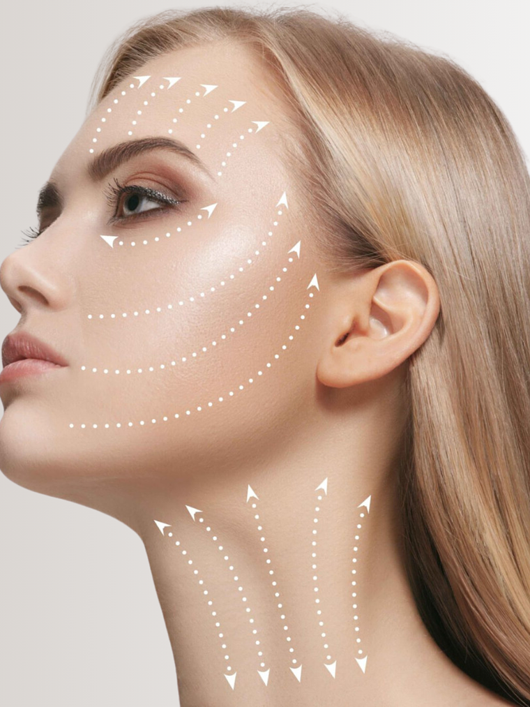 Hilos revitalizantes PDO 1