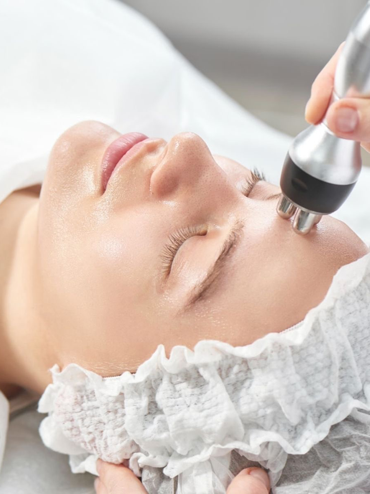 Radiofrecuencia fraccionada 1