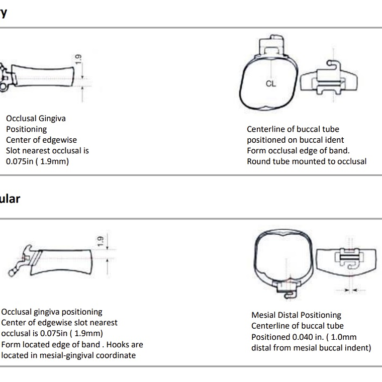 Bandas Planas 1° Molar- U2L1 2
