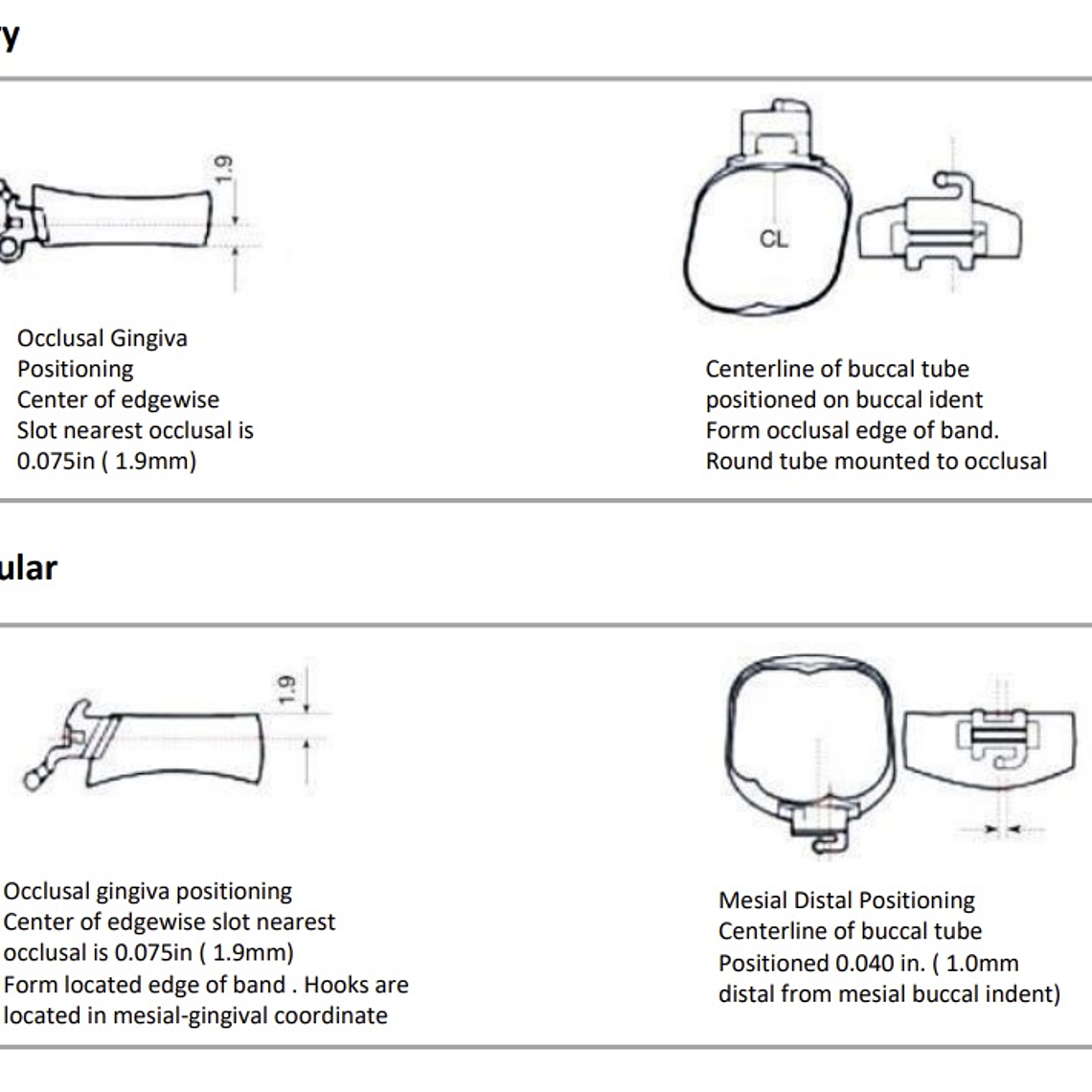 Bandas Planas 1° Molar- U3L2 2