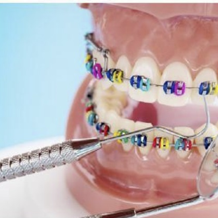 Ligadura Tipo de llave 3