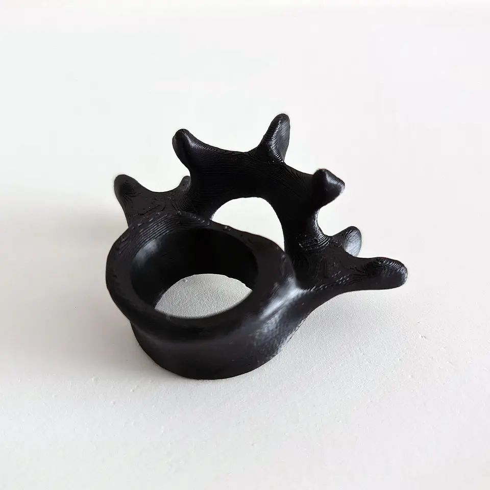 Anillo Vertebrae 2