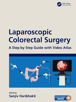  Laparoscopic Colorectal Surgery: A Step by Step Guide with Video Atlas 