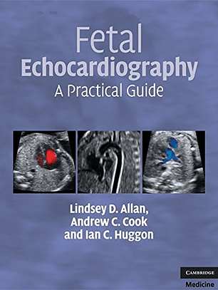 Fetal Echocardiography: A Practical Guide (Allan, Fetal Echocardiography)