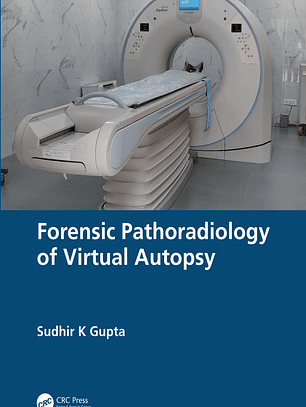 Forensic Pathoradiology of Virtual Autopsy 