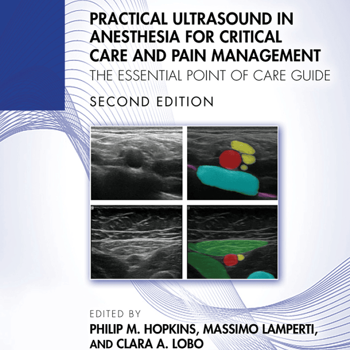 Practical Ultrasound in Anesthesia for Critical Care and Pain Management: The Essential Point of Care Guide 2nd Edition  1