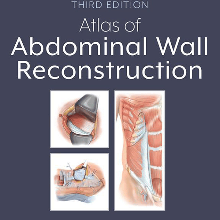 Atlas of Abdominal Wall Reconstruction 3rd Edition 1
