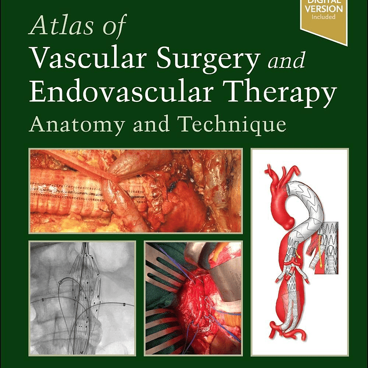 Atlas of Vascular Surgery and Endovascular Therapy: Anatomy and Technique 2nd Edition 1
