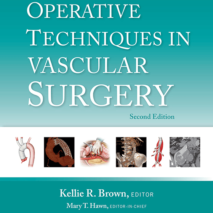 Operative Techniques in Vascular Surgery 2nd Edition 1