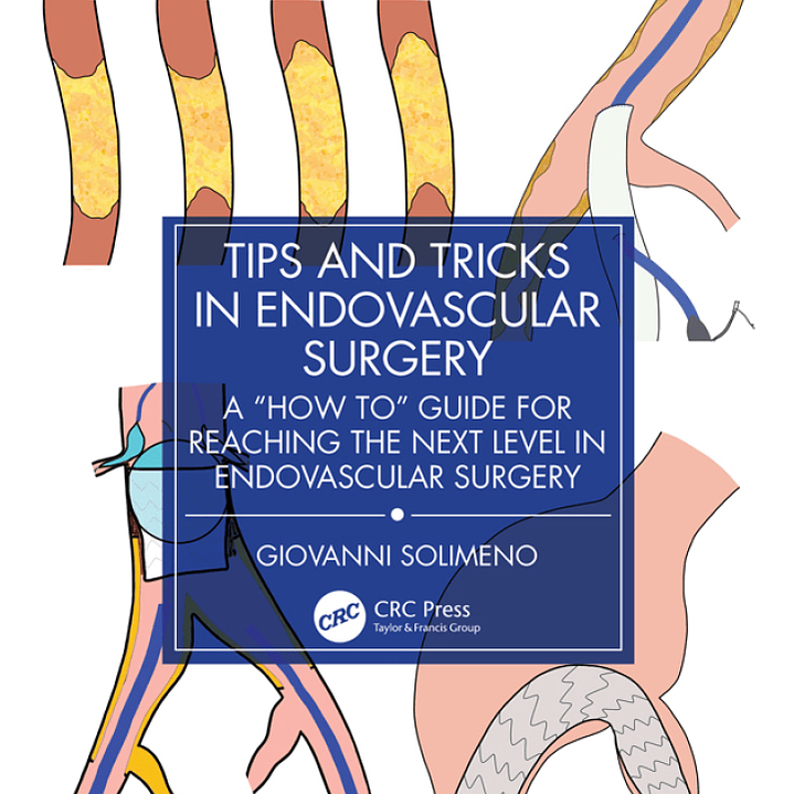 Tips and Tricks in Endovascular Surgery: A 