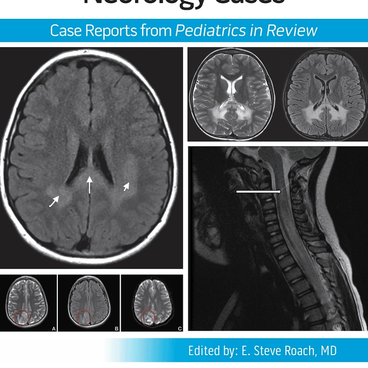 Pediatric Collections: Neurology Cases: Case Reports from Pediatrics in Review 1