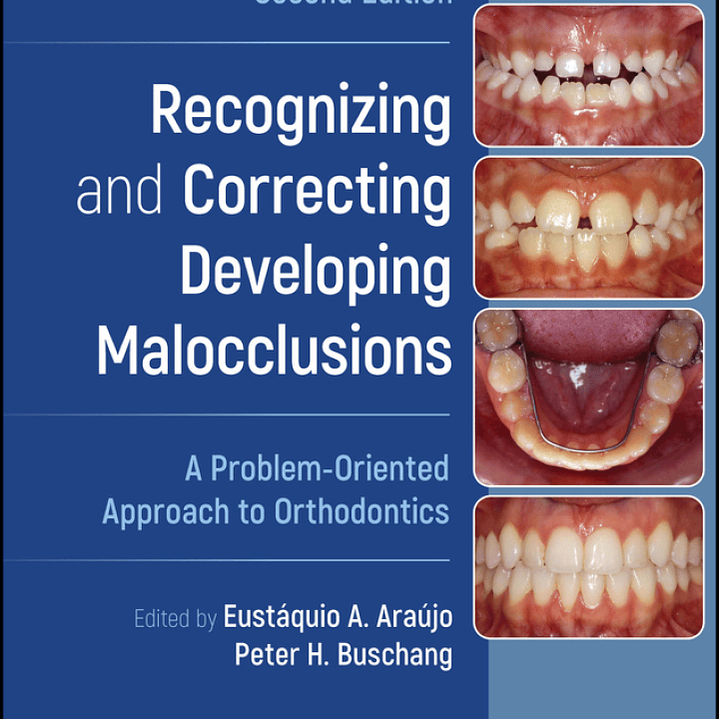Recognizing and Correcting Developing Malocclusions: A Problem-Oriented Approach to Orthodontics 2nd Edition 1
