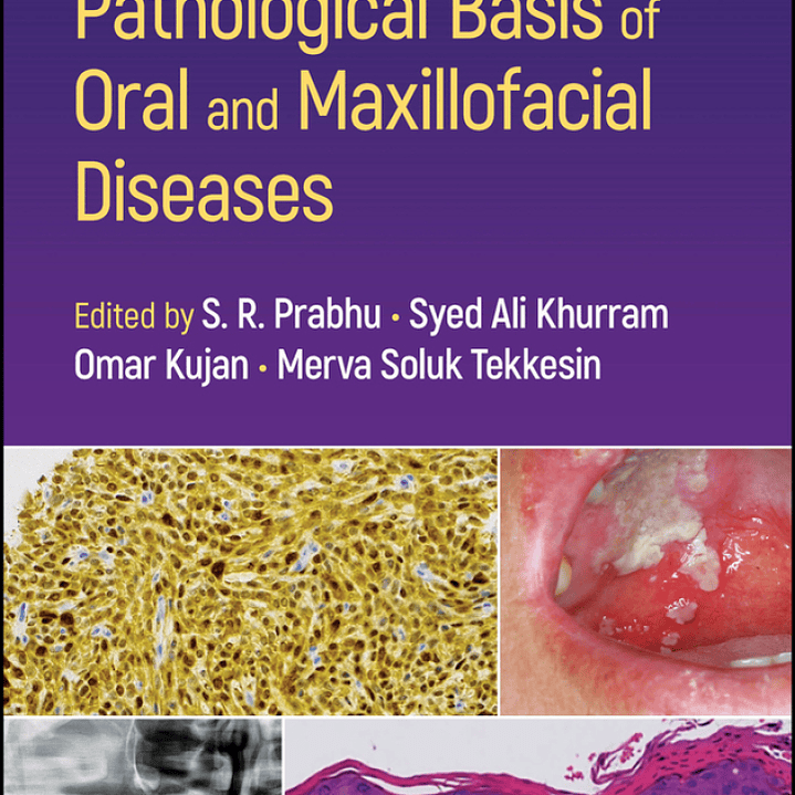 Pathological Basis of Oral and Maxillofacial Diseases  1
