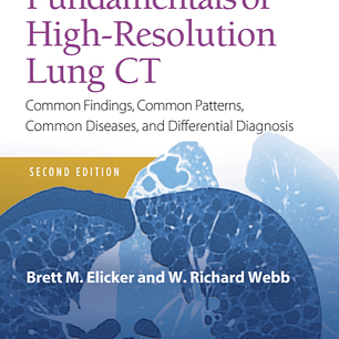 Fundamentals of High-Resolution Lung CT: Common Findings, Common Patterns, Common Diseases and Differential Diagnosis