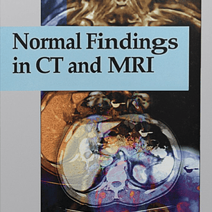 Normal Findings in CT and MRI