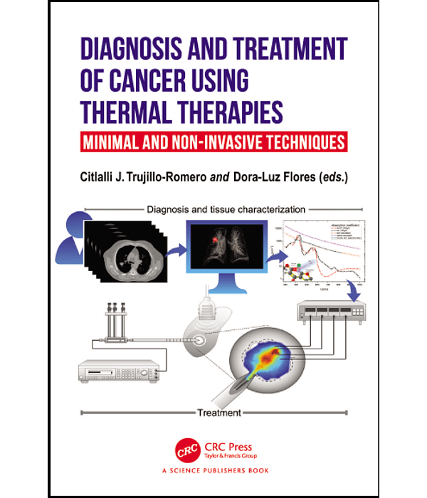 Diagnosis and Treatment of Cancer using Thermal Therapies: Minimal and Non-invasive Techniques 