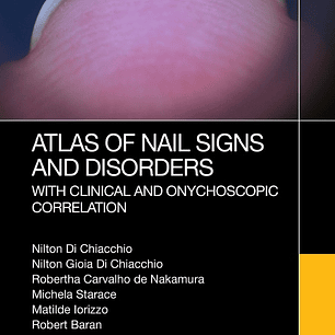 Atlas of Nail Signs and Disorders with Clinical and Onychoscopic Correlation