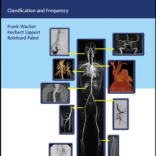 Arterial Variations in Humans: Key Reference for Radiologists and Surgeons: Classification and Frequency 