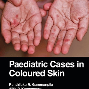 Paediatric Cases in Coloured Skin