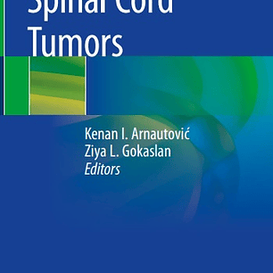  Spinal Cord Tumors 