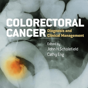Colorectal Cancer: Diagnosis and Clinical Management