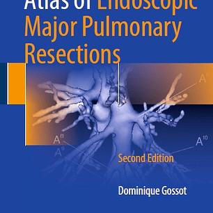 Atlas of Endoscopic Major Pulmonary Resections