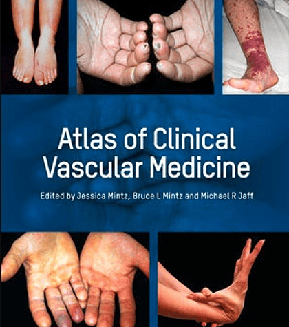 Atlas of Clinical Vascular Medicine